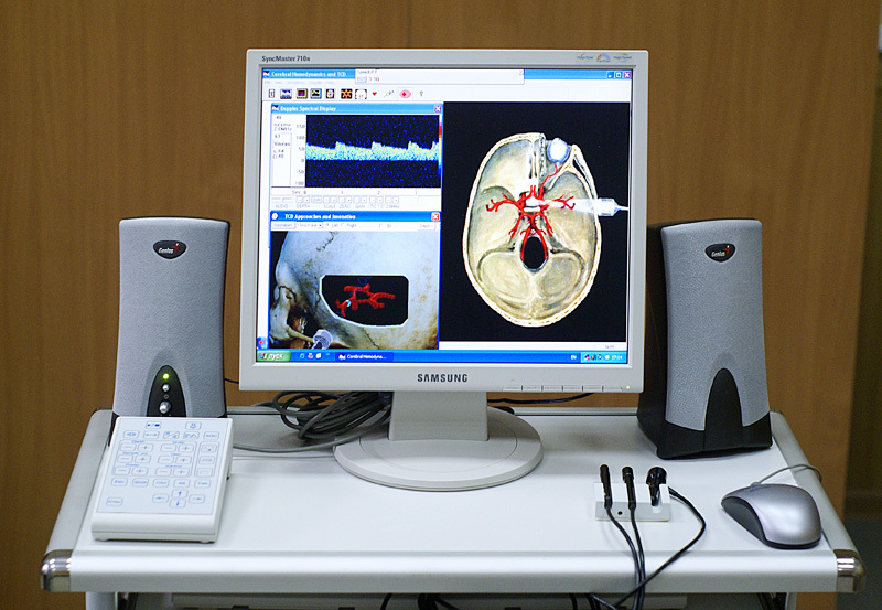 Functional transcranial Doppler ultrasound (fTCD)